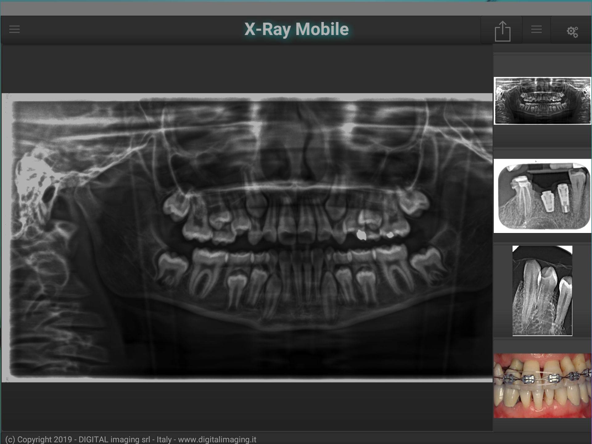 Рентген на андроид бесплатные. X-ray приложение. Программа рентген для андроид. Приложение рентген для андроид настоящий. X-ray рентген.